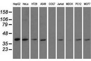 Western blot analysis of extracts (35 µg) from 9 different cell lines by using anti-HIBCH monoclonal antibody. (HIBCH antibody)