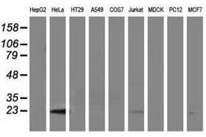 Image no. 2 for anti-Lin-7 Homolog B (LIN7B) antibody (ABIN1499156) (LIN7B antibody)
