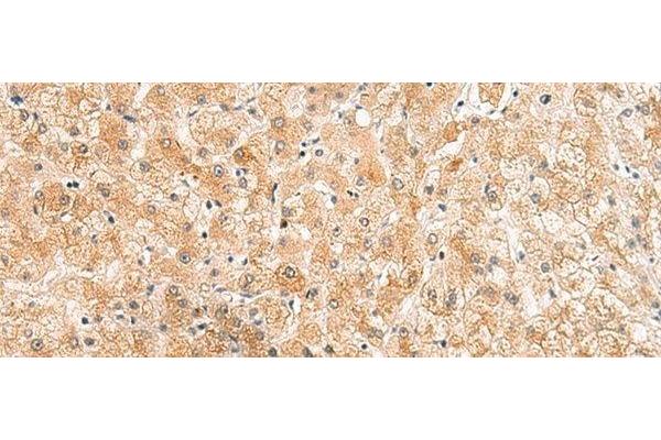 Zinc Finger Protein 185 antibody