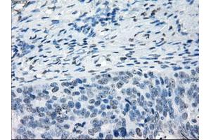 Immunohistochemical staining of paraffin-embedded colon tissue using anti-NAT8mouse monoclonal antibody.
