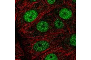 Immunofluorescent staining of MCF7 cells with MCM7 polyclonal antibody  (Green) shows positivity in nucleus but excluded from the nucleoli.