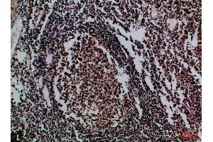 Immunohistochemical analysis of paraffin-embedded Human-tonsil, antibody was diluted at 1:100 (IL17D antibody  (AA 141-190))