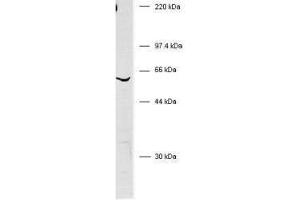 Western blot of anti-human BIVM. (BIVM antibody)