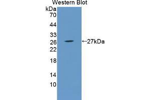 Western blot analysis of the recombinant protein. (Recoverin antibody  (AA 2-200))