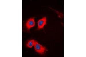 Immunofluorescent analysis of PKC theta staining in HeLa cells. (PKC theta antibody  (C-Term))