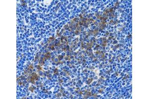 Immunohistochemistry of paraffin-embedded Rat spleen using HSPH1 Polyclonal Antibody at dilution of 1:100 (40x lens). (HSPH1 antibody)