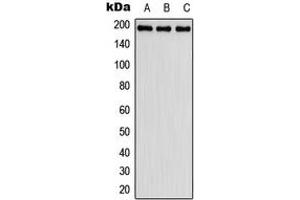 Western blot analysis of Fibulin 2 expression in HeLa (A), SP2/0 (B), H9C2 (C) whole cell lysates. (FBLN2 antibody  (Center))