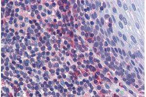 Human Tonsil: Formalin-Fixed, Paraffin-Embedded (FFPE) (JNK2 antibody  (AA 1-425))