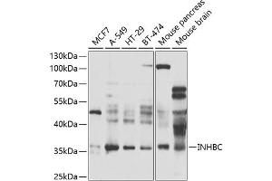 Western blot analysis of extracts of various cell lines, using INHBC antibody (ABIN6131317, ABIN6142463, ABIN6142464 and ABIN6223466) at 1:1000 dilution.