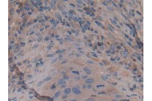 Immunohistochemistry (IHC) image for anti-rho-Associated, Coiled-Coil Containing Protein Kinase 2 (ROCK2) (AA 904-1140) antibody (ABIN7434197)