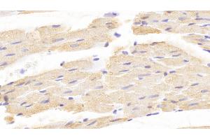 Detection of CRHBP in Rat Cardiac Muscle Tissue using Polyclonal Antibody to Corticotropin Releasing Hormone Binding Protein (CRHBP) (CRHBP antibody  (AA 25-322))