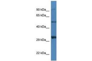 Image no. 1 for anti-Sarcoglycan, delta (35kDa Dystrophin-Associated Glycoprotein) (SGCD) (AA 37-86) antibody (ABIN6746239) (SGCD antibody  (AA 37-86))