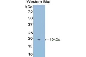 Detection of Recombinant SOD1, Rat using Polyclonal Antibody to Superoxide Dismutase 1 (SOD1) (SOD1 antibody  (AA 2-154))