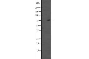 Western blot analysis of TAB2 expression in HEK293 cells ,The lane on the left is treated with the antigen-specific peptide. (TAB2 antibody  (Internal Region))