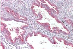 Human Uterus: Formalin-Fixed, Paraffin-Embedded (FFPE) (MYF5 antibody  (AA 7-36))