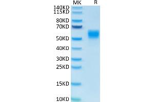 IL-13 Protein (AA 21-132) (Fc Tag)
