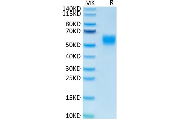 IL-13 Protein (AA 21-132) (Fc Tag)