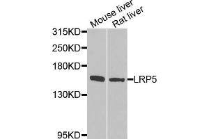 Western blot analysis of extracts of various cell lines, using LRP5 antibody (ABIN5974915) at 1/1000 dilution. (LRP5 antibody)