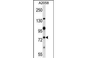 Western blot analysis in A2058 cell line lysates (35ug/lane). (NEK8 antibody  (C-Term))