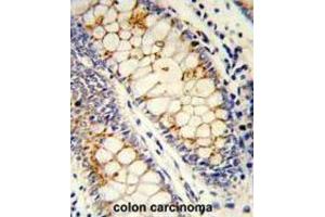 Immunohistochemistry (IHC) image for anti-serine/arginine-Rich Splicing Factor 1 (SRSF1) antibody (ABIN3002838) (SRSF1 antibody)