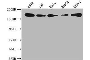 Western Blot Positive WB detected in: A549 whole cell lysate, 293 whole cell lysate, Hela whole cell lysate, HepG2 whole cell lysate, MCF-7 whole cell lysate All lanes: PLXNB2 antibody at 1:1000 Secondary Goat polyclonal to rabbit IgG at 1/50000 dilution Predicted band size: 206 kDa Observed band size: 206 kDa (Plexin B2 antibody  (AA 1458-1673))