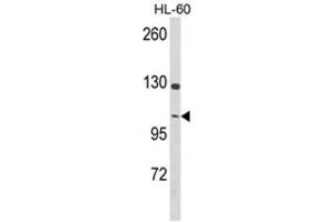 Western blot analysis of Dynamin 3 Antibody (Center) in HL-60 cell line lysates (35ug/lane). (Dynamin 3 antibody  (Middle Region))