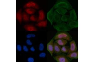 ABIN6260720 and ABIN6276822 staining Hela cells by IF/ICC. (CDK7 antibody  (Internal Region))