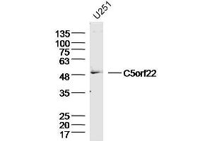 U251 Cell lysates probed with C5orf22 Polyclonal Antibody, unconjugated  at 1:300 overnight at 4°C followed by a conjugated secondary antibody for 60 minutes at 37°C. (C5ORF22 antibody  (AA 301-400))