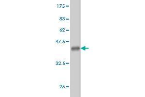 Western Blot detection against Immunogen (36. (GUK1 antibody  (AA 100-197))