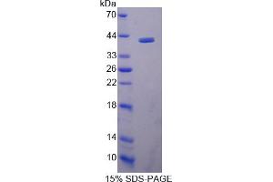 Image no. 1 for Wingless-Type MMTV Integration Site Family, Member 5B (WNT5B) (AA 35-363) protein (His tag) (ABIN4991036)