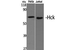 Western Blotting (WB) image for anti-Hemopoietic Cell Kinase (HCK) (Ser468) antibody (ABIN3184982) (HCK antibody  (Ser468))
