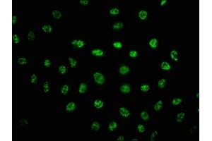 Immunofluorescence staining of Hela cells(treated with UV) with ABIN7127732 at 1:100,counter-stained with DAPI. (Recombinant PRKDC antibody  (pSer2056))