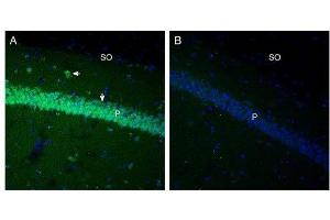 Expression of GPR91 in mouse hippocampus. (SUCNR1 antibody  (3rd Extracellular Loop))