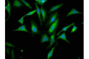 Immunofluorescence staining of Hela cells with ABIN7156276 at 1:66, counter-stained with DAPI. (Pyrophosphatase (Inorganic) 1 (PPA1) (AA 59-173) antibody)