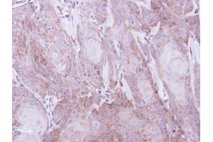 IHC-P Image Immunohistochemical analysis of paraffin-embedded Cal27 xenograft, using SEC61A1, antibody at 1:500 dilution. (SEC61A1 antibody  (C-Term))
