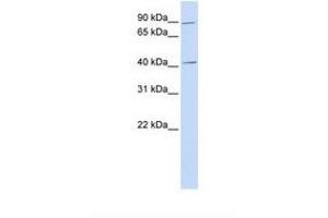 Image no. 1 for anti-Ubiquitin Specific Peptidase 18 (USP18) (AA 110-159) antibody (ABIN6738233) (USP18 antibody  (AA 110-159))