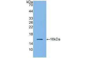 Detection of Recombinant GLP1R, Mouse using Polyclonal Antibody to Glucagon Like Peptide 1 Receptor (GLP1R) (GLP1R antibody  (AA 25-145))