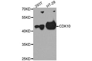 Western blot analysis of extracts of various cell lines, using CDK10 antibody.