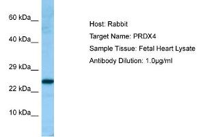 Western Blotting (WB) image for anti-Peroxiredoxin 4 (PRDX4) (C-Term) antibody (ABIN2789801) (Peroxiredoxin 4 antibody  (C-Term))