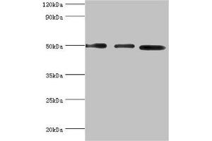 Western blot All lanes: Adenylosuccinate synthetase isozyme 2 antibody at 12 μg/mL Lane 1: Mouse skeletal muscle tissue Lane 2: HepG2 whole cell lysate Lane 3: K562 whole cell lysate Secondary Goat polyclonal to rabbit IgG at 1/10000 dilution Predicted band size: 50 kDa Observed band size: 50 kDa (ADSS antibody  (AA 1-280))
