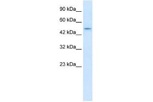 Western Blot showing ZNF651 antibody used at a concentration of 1-2 ug/ml to detect its target protein. (ZBTB47 antibody  (N-Term))