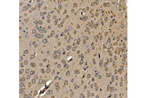 IHC analysis of SRP72 using anti-SRP72 antibody (ABIN7601648).