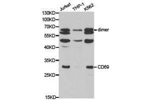 Western Blotting (WB) image for anti-CD69 (CD69) antibody (ABIN1871647) (CD69 antibody)
