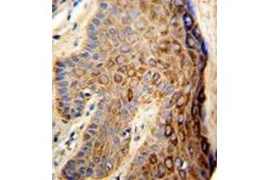 Formalin-fixed and paraffin-embedded human skin reacted with FAM96B Antibody (N-term) followed which was peroxidase-conjugated to the secondary antibody, followed by DAB staining. (FAM96B antibody  (C-Term, N-Term))