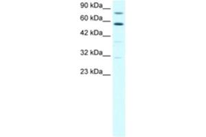 Western Blotting (WB) image for anti-Staphylococcal Nuclease Domain Containing Protein 1 (SND1) antibody (ABIN2460503) (SND1 antibody)