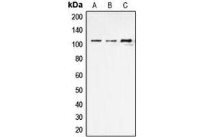 Western blot analysis of ERAP1 expression in THP1 (A), NIH3T3 (B), rat kidney (C) whole cell lysates. (ERAP1 antibody  (Center))