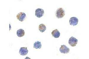 Immunocytochemical staining of AIF in K562 cells with AIF antibody at 5 μg/ml. (AIF antibody)