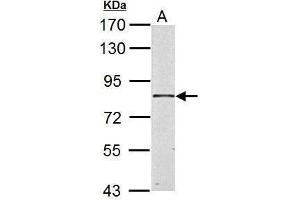 WB Image HSD17B4 antibody detects HSD17B4 protein by Western blot analysis.