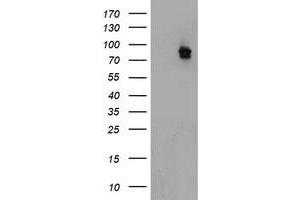 HEK293T cells were transfected with the pCMV6-ENTRY control (Left lane) or pCMV6-ENTRY ATRIP (Right lane) cDNA for 48 hrs and lysed. (ATRIP antibody  (AA 42-309))