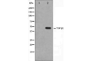 Western blot analysis of TGF beta2 Antibody expression in mouse brain tissue lysates.